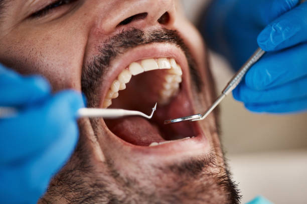 Best Emergency Root Canal Treatment in Falmouth Foreside, ME