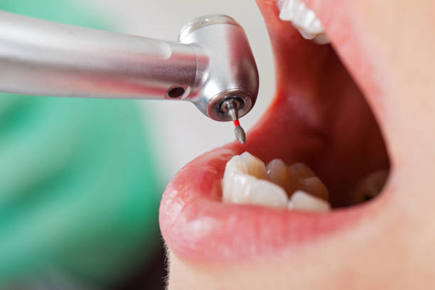 Best Orthodontic Emergency Dentist in Falmouth Foreside, ME